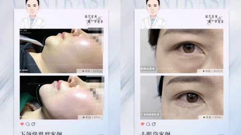 在沈阳，以下几位医生在韩式双眼皮领域具有较高的声誉和技术水平：