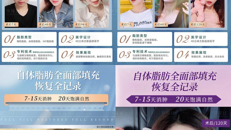 玻尿酸除皱，鱼尾纹费用几何？揭秘除皱美容的真相**