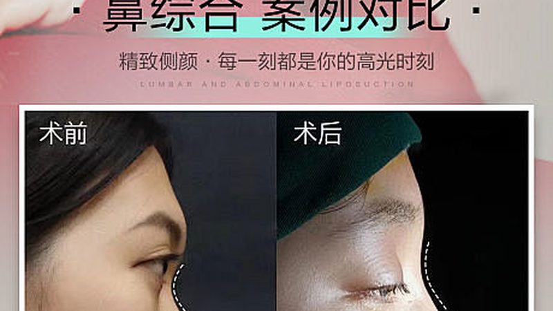 轻医美产品：揭秘效果与时长之谜
