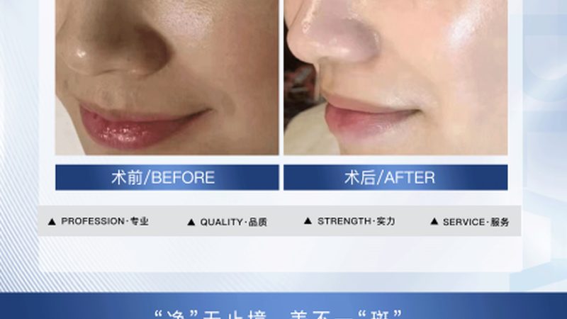 水光针原液：肌肤深层补水神器