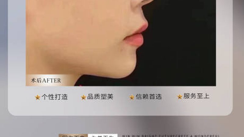医美咨询师报价表Excel下载