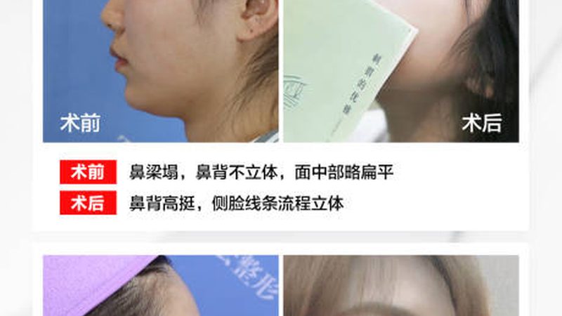 岁女人抗衰饮食怎么吃