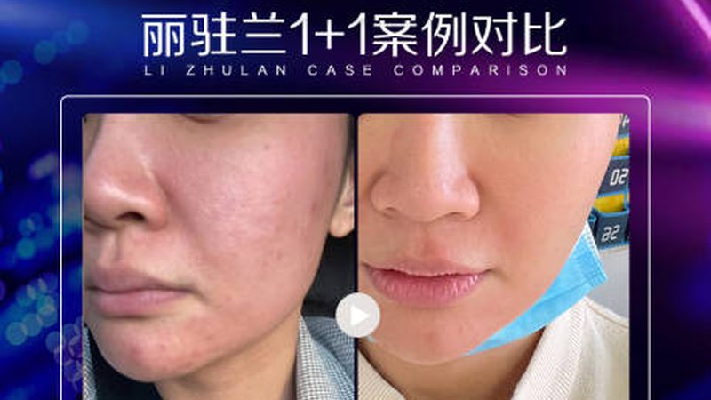 揭秘抗衰干细胞治疗：性价比背后的秘密