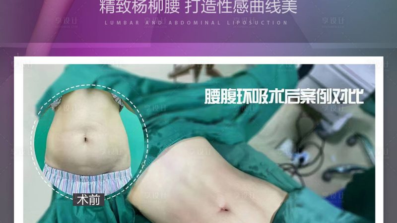 激光祛痘印与果酸换肤：两种祛痘印方法的全面对比
