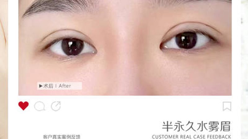 皮肤管理加盟店项目：揭秘收费背后的逻辑