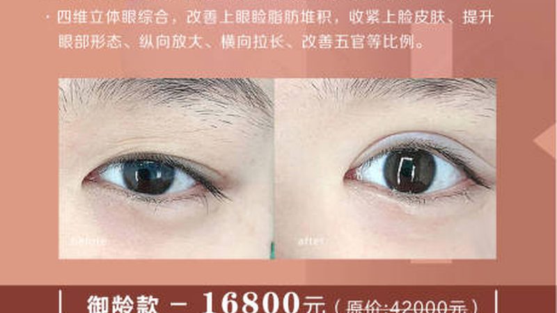 口服玻尿酸补水效果能维持多久