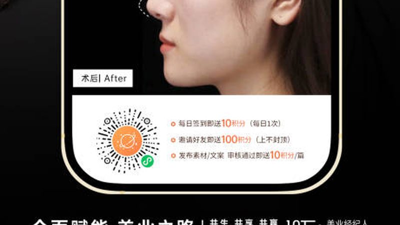 颏成型手术，塑造完美下颌线的关键解析