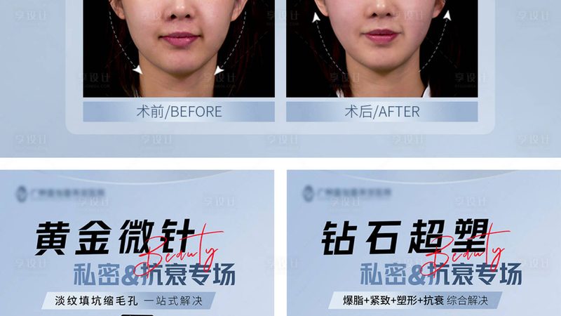 激光美容祛斑仪器型号参数大全