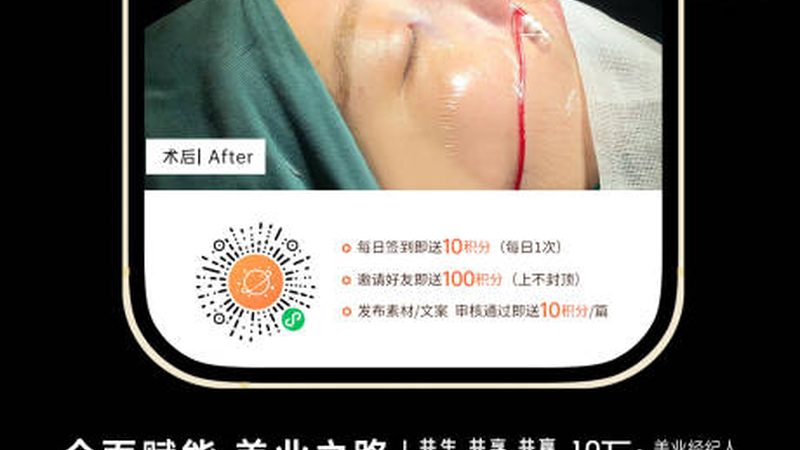 肋软骨隆鼻：初鼻与修复鼻，哪种更适合你？**