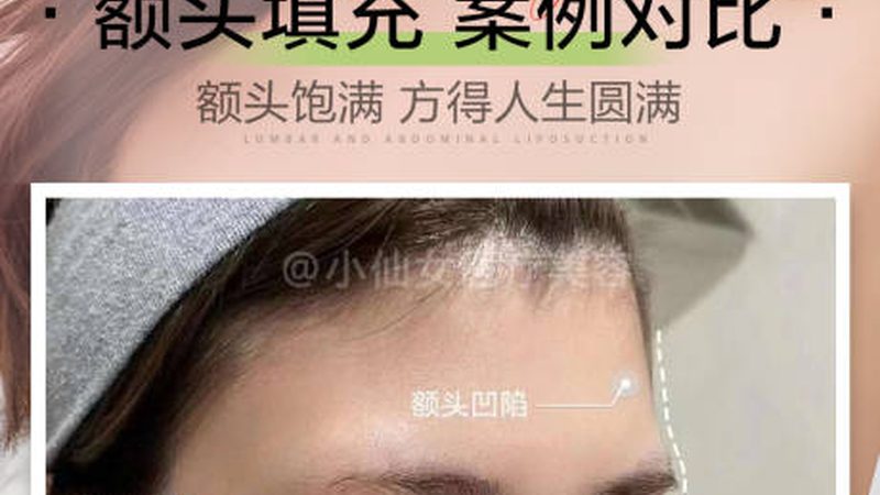 沈阳韩式双眼皮手术：揭秘费用构成与合理选择